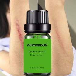 MasajeEliminación de cicatrices " tratamiento de acné - aceite de masaje de lavanda 10 ml