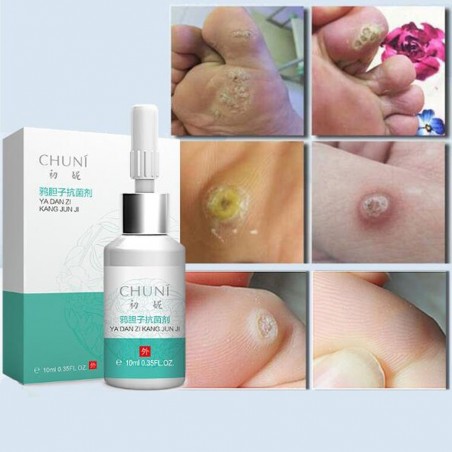 PielLíquido para la eliminación de etiquetas de la piel - lunares - verrugas - 10 ml
