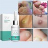PielLíquido para la eliminación de etiquetas de la piel - lunares - verrugas - 10 ml