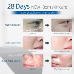 Mascarillas bucalesPDT LED face mask - light therapy - skin tightening / rejuvenation / dark spots remover - 7 colors