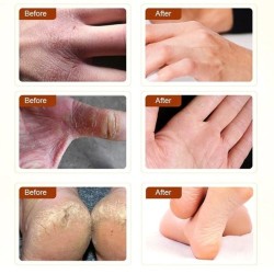Horse oil ointment - hand / foot repair cream - moisturizerSkin