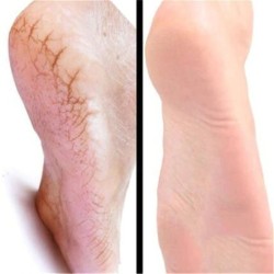 Horse oil ointment - hand / foot repair cream - moisturizerSkin