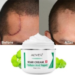 PielCrema para eliminar cicatrices - estrías - marcas de acné - tratamiento facial / corporal - 50 ml