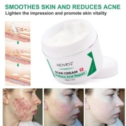 PielCrema para eliminar cicatrices - estrías - marcas de acné - tratamiento facial / corporal - 50 ml