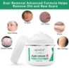 PielCrema para eliminar cicatrices - estrías - marcas de acné - tratamiento facial / corporal - 50 ml