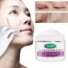 PielCrema para eliminar cicatrices - estrías - marcas de acné - tratamiento facial / corporal - 50 ml