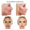 MasajeMasajeador de ojos EMS - antiarrugas - eliminación de ojeras - compresa caliente - LED - USB