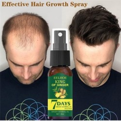 Hair growth essence - anti hair loss sprayHair