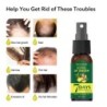 CabelloEsencia para el crecimiento del cabello - spray anticaída