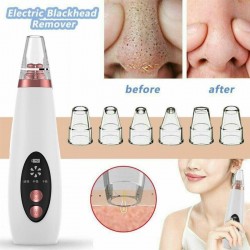 PielEliminador de puntos negros / acné - Limpiador de poros faciales - Cuidado facial con succión al vacío - USB