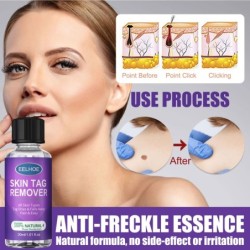 PielRemovedor de verrugas / verrugas - manchas oscuras / pecas - líquido - 30 ml