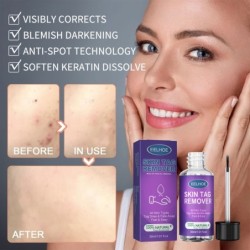 PielRemovedor de verrugas / verrugas - manchas oscuras / pecas - líquido - 30 ml