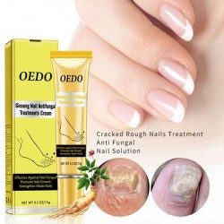 Fungal nail treatment - hand / feet / nails cream - ginseng - 15 grTreatment