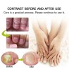 TratamientoTratamiento de hongos en las uñas - crema para manos / pies / uñas - ginseng - 15 gr