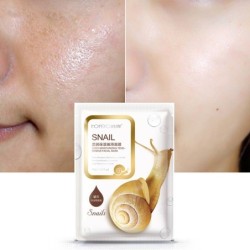 PielMascarilla facial de esencia de caracol - hidratante - control de aceite - tratamiento del acné - 5 piezas