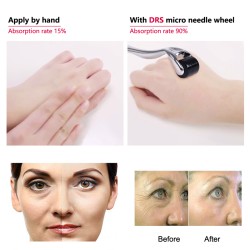 PielDerma roller - microneedling - aguja de titanio - para rostro / cuello