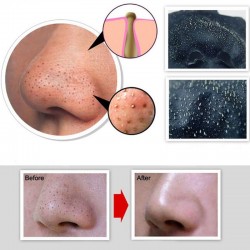 PielDesmontador de acné de la cabeza negra - limpieza profunda purificación cáscara de la cara máscara 50 ml